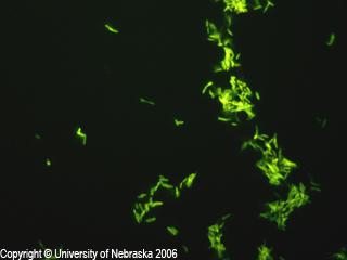 irregularly, giving a beaded appearance, or may not stain at all. Specific staining techniques have been developed to detect mycobacteria.
