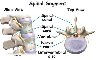 This is especially true when hardware or instrumentation is used and inserted near nerves, or when a curvature of the spine is corrected.