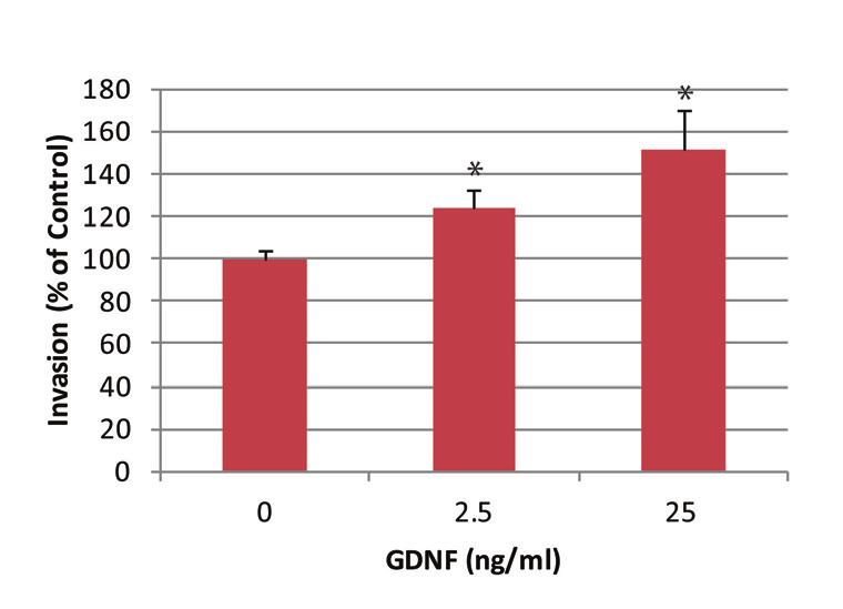 Major Task 2: In vitro studies of GDNF. Subtask 1:
