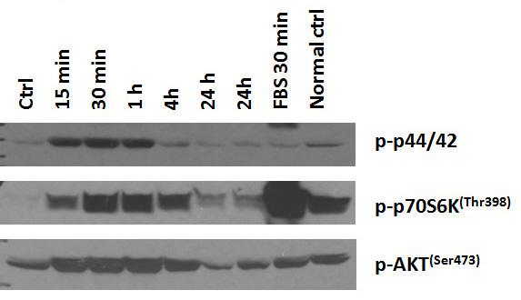 Phosphorylated RET was detected by IP-Western. RET was detected by Western blot of input cell lysates Figure 7. Pathway activation by RET signaling in 22RV1 cells.