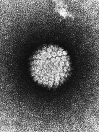 HPV Vaccine Protects against Human Papillomavirus (HPV) Viral infection genital warts, cancer How common is it? 79mil infected in US, 14mil new cases/yr.
