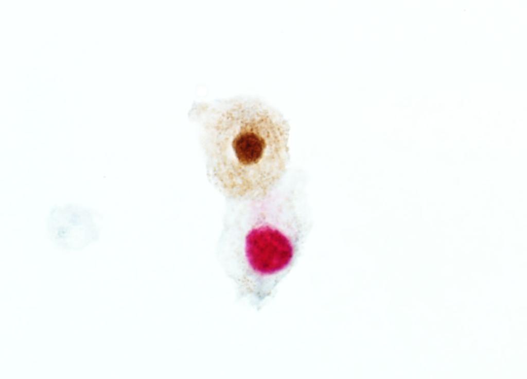 1. Isolated cell Cluster 2.