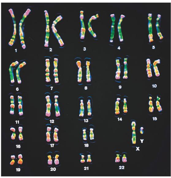 Sex Determination: Overview Dimorphism: Males sperm Females eggs Chromosomes