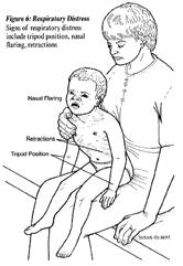 Clinical Red Flags Physical Appearance Child leans forward as position of comfort Accessory muscles used in neck, intercostal area, sternum Looks distressed, anxious or agitated Quality of Breath