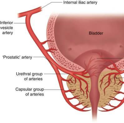 Prostatic Supply Arterial supply Inferior vesical artery from Internal Iliac Artery.