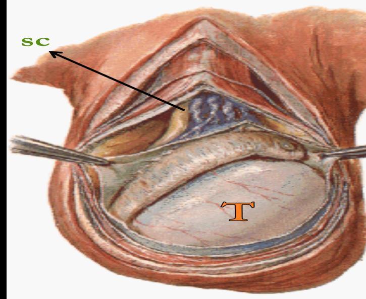 It is found deep to the Fascia of Camper and superficial to the external oblique muscle. Testes Extra o Testis or Testicle (singular), Testes (plural).