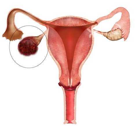 Structures of the female reproductive Ovary (female gonad)- (2) located on either side of