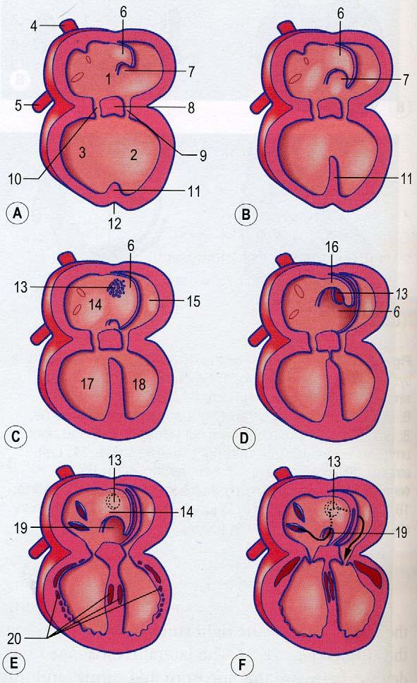 * The septum primum(6) divides the common atrium(1) into right(14) and left(15) atria. * Initially the foramen primum(7) persists as an opening, but it eventually closes.