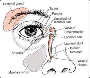 Lacrimal Drainage System Dacryocystitis NLD