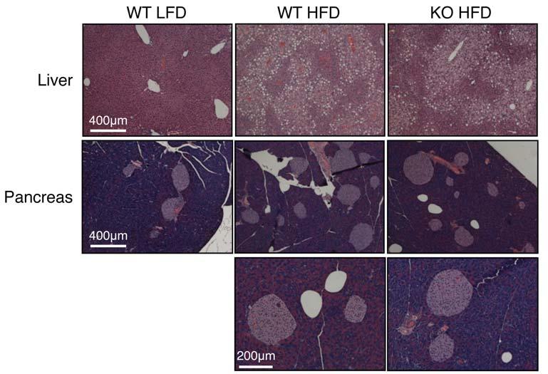 The LFD mice were age-matched with 6w HFD mice. Note the increase of adipose-infiltrating cells upon long-term HFD.