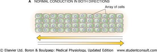 Unidirectional block Partial conduction block in which