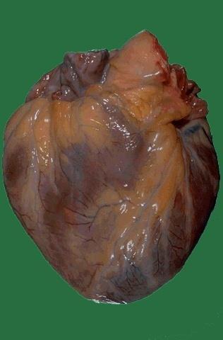 Views of the Heart Some leads get a good view of the: Anterior portion of the heart Leads V1 V4