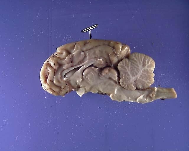 Physiological Psychology Laboratory Manual 4 Coronal/Frontal Dissection of the Right Hemisphere of the Sheep Brain Place a paper towel on the laboratory table surface and arrange the dissecting frame