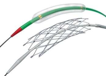 Intracranial stenosis- Angioplasty and Stenting Gateway balloon and Wingspan stent Developed for intracranial