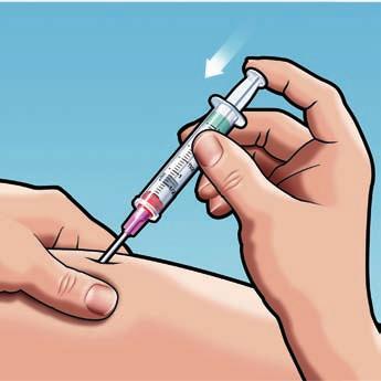 3 4 STEP 3: Because the solution is somewhat viscous, the injection may take 5 to