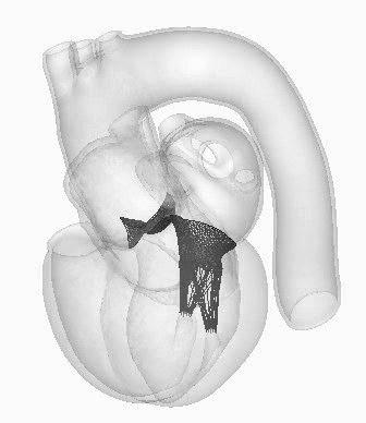 moving valves (Aortic, Mitral), blood flow