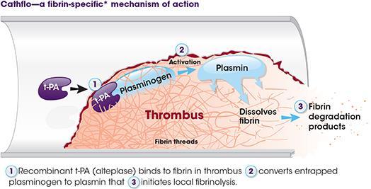Thrombolytics Thrombolysis is indicated for hemodynamically unstable patients with pulmonary embolism. Thrombolysis dramatically improves acute cor pulmonale.