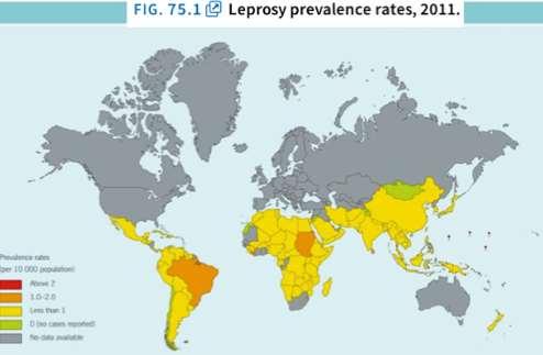 History and Prevalence 600 and 200 BC: First case of Leprosy reported in India/China. 1873: G.H. Armoeur Hansen discovered Leprosy.