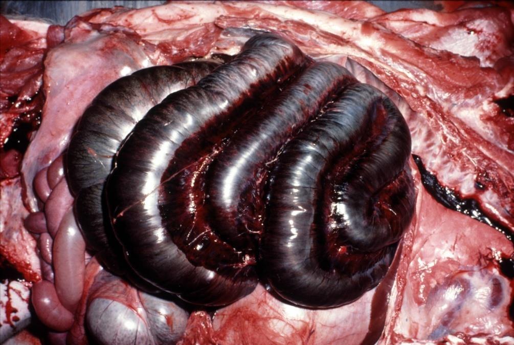 Twisting on mesenteric axis (volvulus) Left colon in