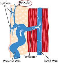 Reticular Veins Also known as feeder veins, reticular veins are dilated veins that appear as blue or green lines under the skin, affecting as many as 80% of all adults.