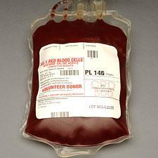 Red cells Appx Hct is 75% Appx volume is 250 ml (RBC 200ml; 50ml plasma) With