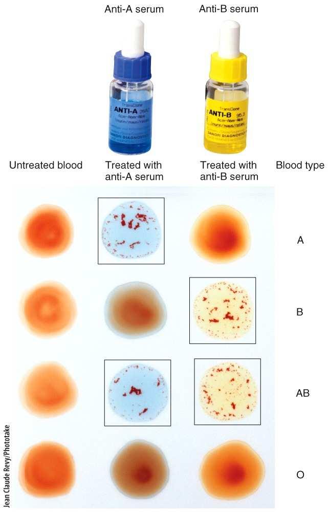 Blood Groups and Blood Types In order to determine a person s blood type, typing and cross-matching are performed.