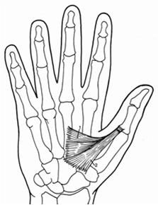 At what level would you suspect injury if dorsal ulnar