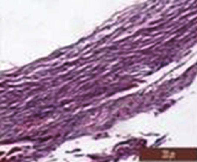 BioMed Research International 5 (a) (b) (c) (d) (e) (f) Figure 4: (a), (c), and (e) are the HE and CD34 immunohistochemical