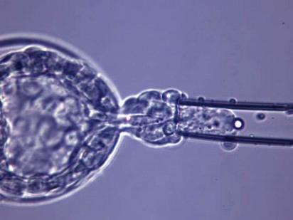 STEP 9: PREIMPLANTATION GENETIC TESTS(PGS, PGD) The processes composed of blastocyst biopsy to remove a few cells from
