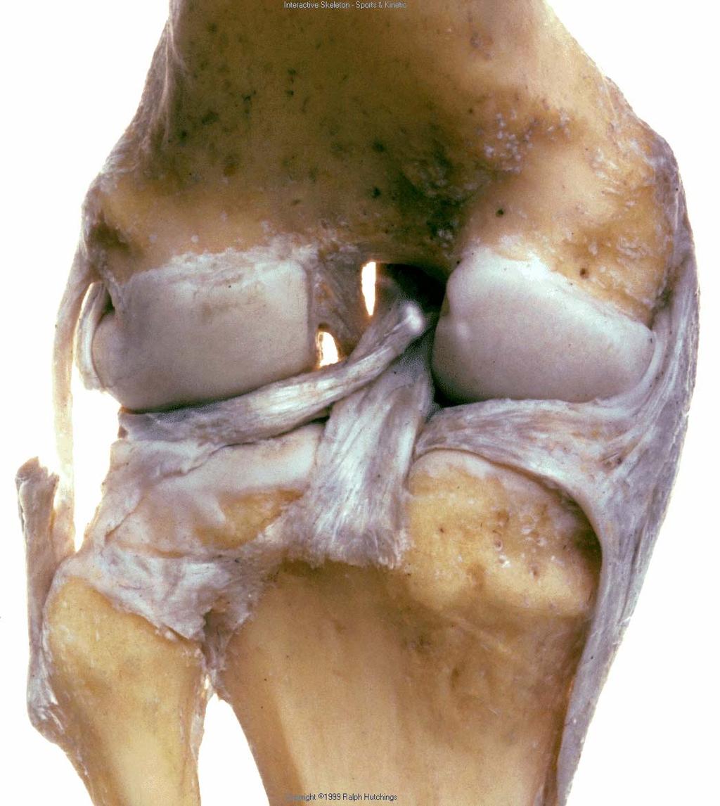 Posterior Cruciate Ligament Prevents posterior translation of the tibia