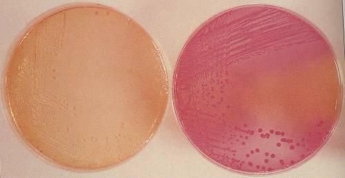 Growth of Enterobacteriaceae on MacConkey agar Colorless