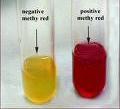 Results IMViC test: MR/VP test Methyl Red test