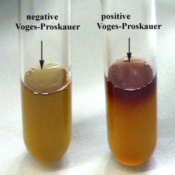 Red: Positive MR (E. coli) No pink: Negative VP (E.