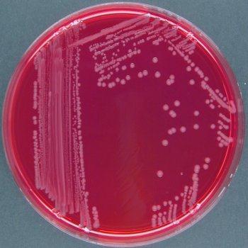 sucrose. Escherichia coli on BPLS Agar.