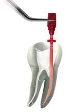 For an easy and warm 3D root canal filling GUTTAFUSION for