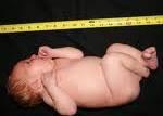 birth weight, head circumference