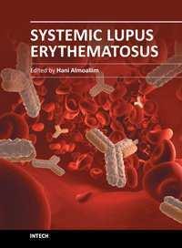 Systemic Lupus Erythematosus Edited by Dr Hani Almoallim ISBN 978-953-51-0266-3 Hard cover, 554 pages Publisher InTech Published online 21, March, 2012 Published in print edition March, 2012 This
