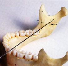 Jastak, Yagiela & Donaldson, Local Anesthesia of the Oral Cavity, WB Saunders Co, 1995