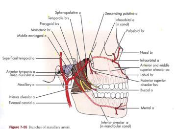 Infratemporal Fossa Pterygopalatine fossa opens into medial wall Boundaries: A gap between the maxilla anteriorly and the lateral pterygoid plate of the sphenoid bone posteriorly Leaves an opening,