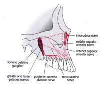 alveolar nerve block The AMSA palatal approach vs.