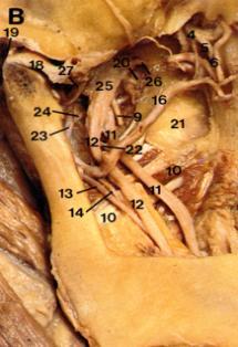 Pterygoid venous plexus 2. Posterior superior alveolar vessels 3. Inferior alveolar vessels 4.