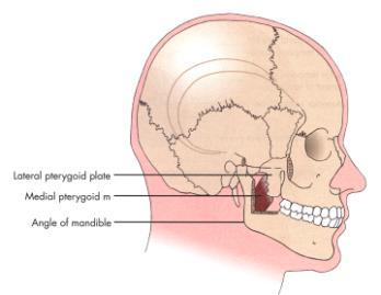 The Muscles of Mastication Four total: 2 superficial; 2 deep The Muscles of Mastication Four total: 2 superficial; 2 deep 1. Temporalis 2. Masseter 3.