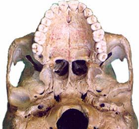 Communications of Infratemporal Fossa Temporal fossa Cranial fossa : foramen ovale & foramen spinosum Orbital