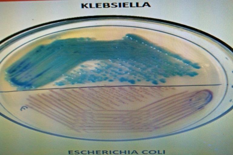 Figure.1 KPC ChromAgar Figure.2 Blue Carba Test CRE is becoming a significant infection control concern and its appropriate detection has become vital in patient management.