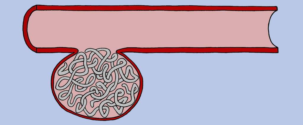 Artery Hydrophilic Coating Aneurysm