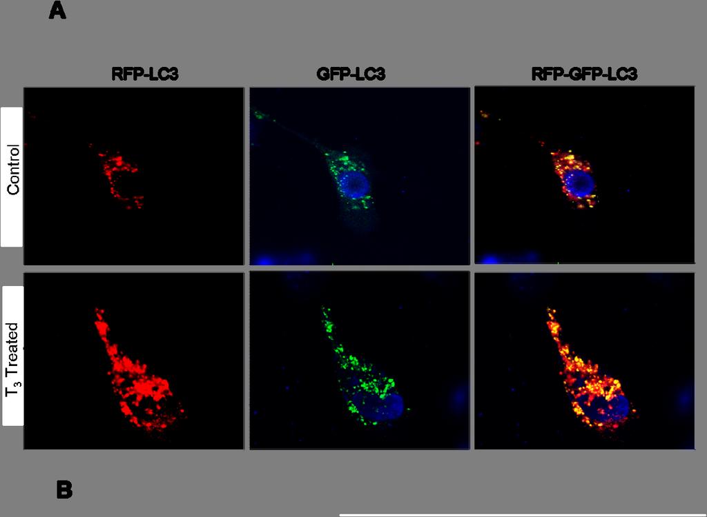 Suppl. Figure 1. T 3 induces autophagic flux in hepatic cells.