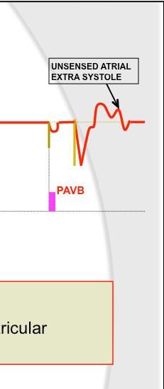 Fifth Timing Cycle to Prevent AV Crosstalk QRS COMPLEX VENTRI EXTRA SYSTOLE UND EXTRA SYSTOLE 5 PAVB PAVB PAVB PAVB PVAB after an atrial pace No PVAB after atrial sensing AV Crosstalk The disturbance
