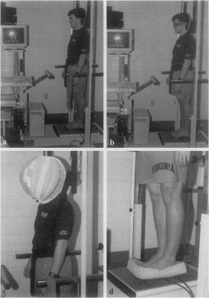 The first study on balance in concussion 1996 Series of postural stability tasks, challenging one system at a time Computerized Dynamic Posturography Significant changes post
