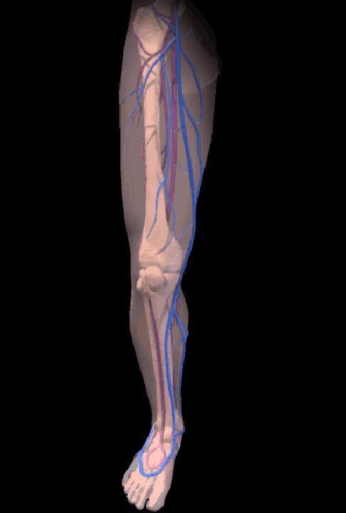 WHY USE LASERS FOR LEG VEINS?