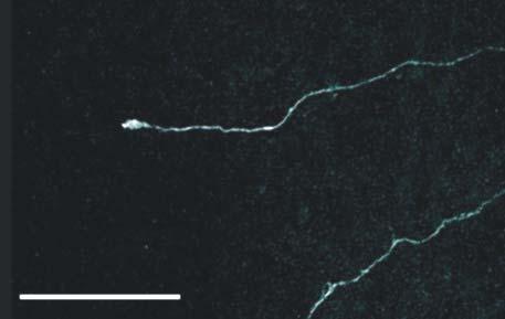 an avascular stromal region. Arrows indicate a TRPV1-IR nerve fiber running through, arrowhead indicates the terminal of thetrpv1-positive nerve fiber. Scale bar=50 µm in a and b. Fig.